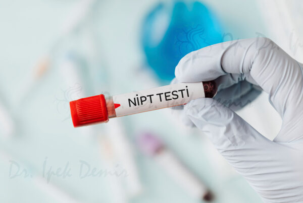 nipt testi nedir