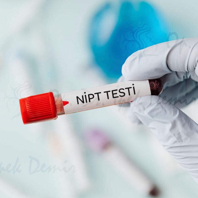 nipt testi nedir