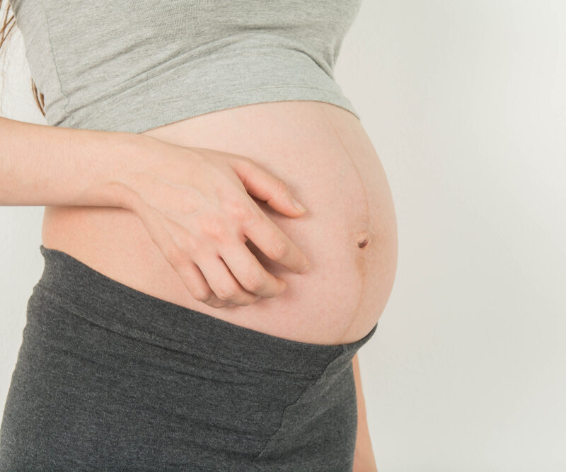 hamilelikte kaşıntı